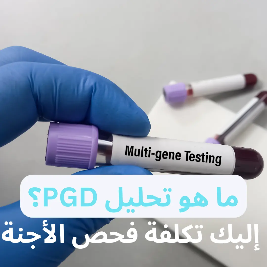 تحليل PGD